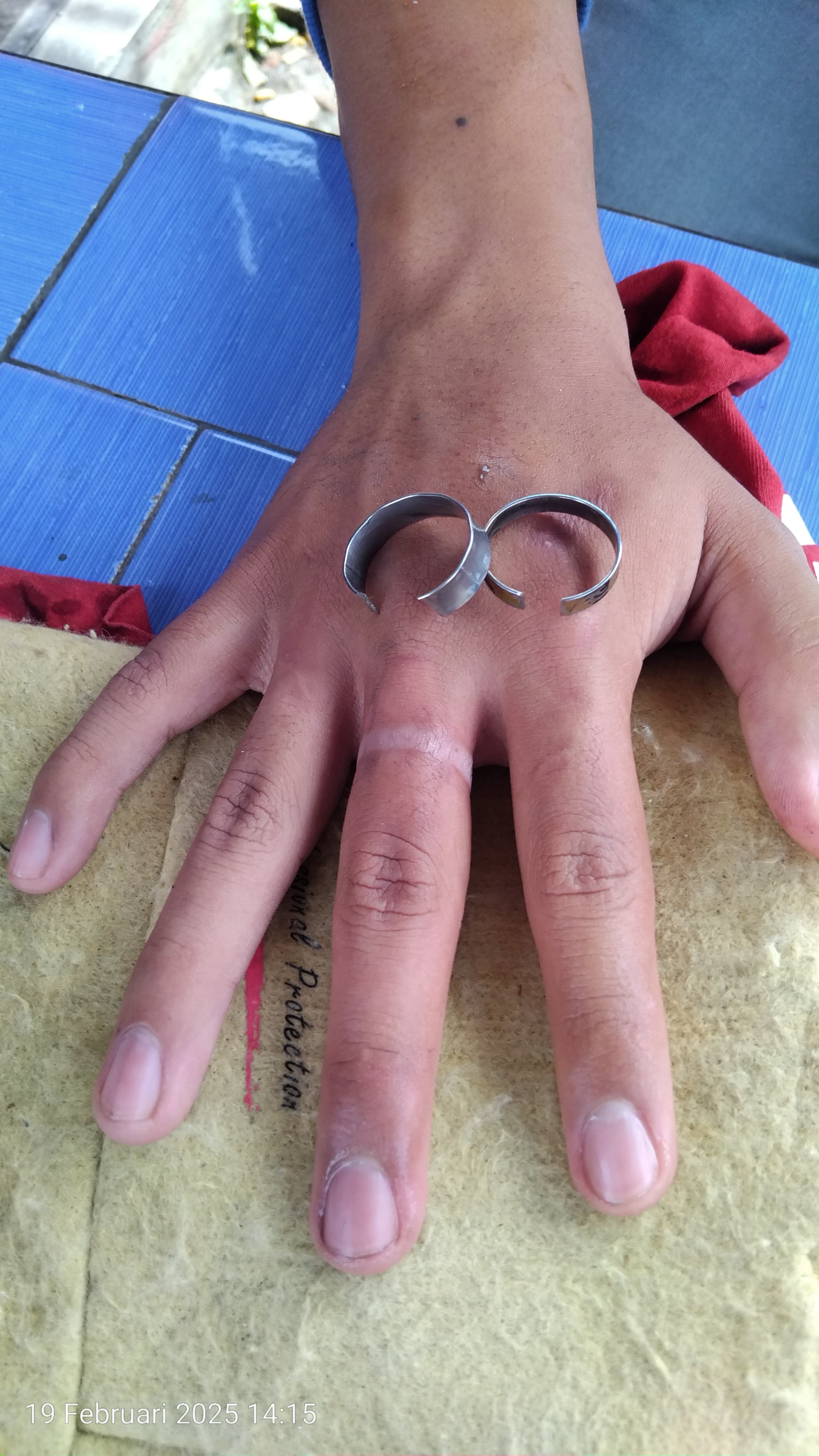 Pelepasan cincin dari Jari seorang pelajar yang tidak bisa dilepas yang beralamat tinggal di Jl. Si