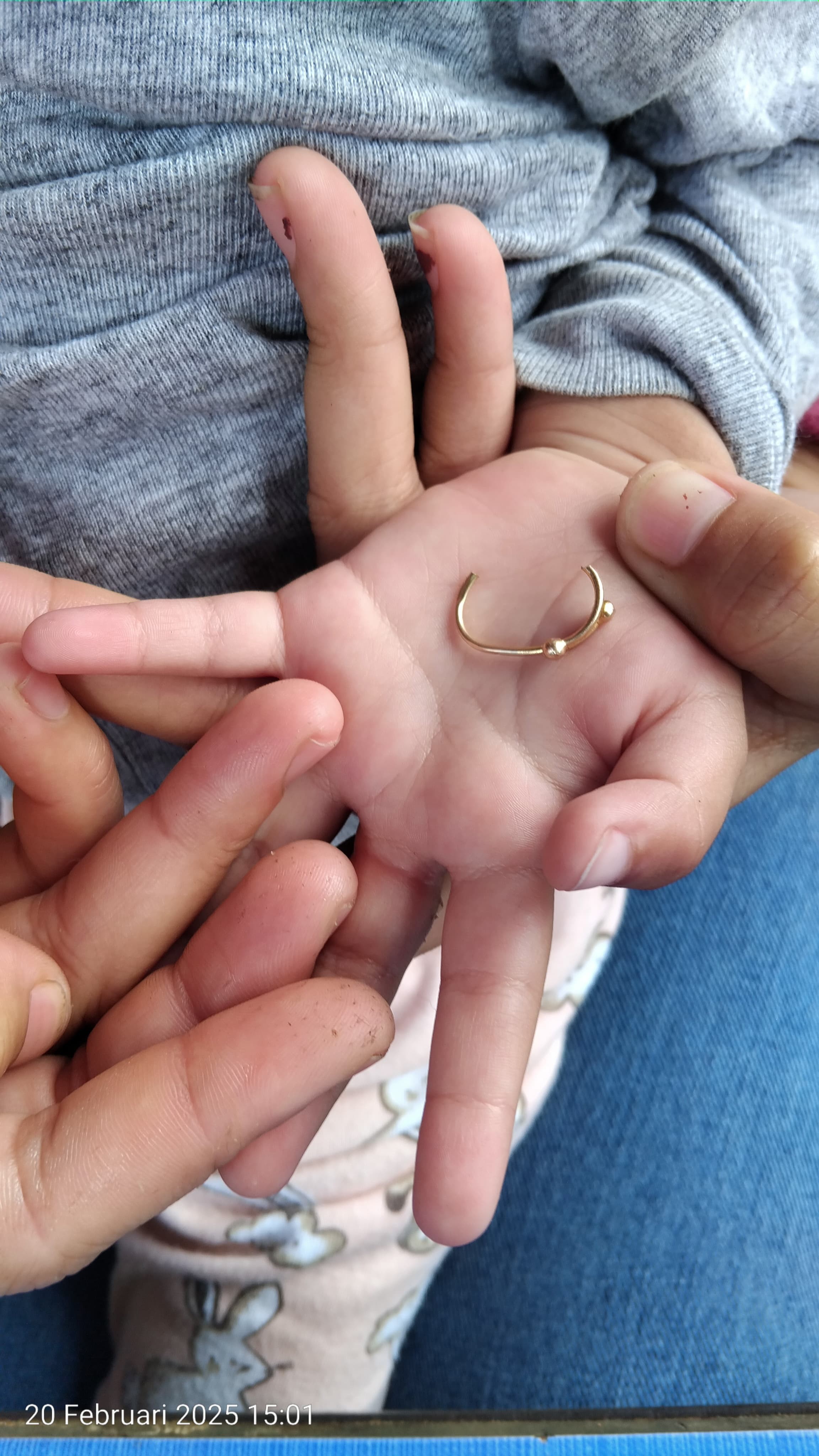 Pelepasan cincin dari Jari seorang Balita yang tidak bisa dilepas yang beralamat tinggal di Desa S