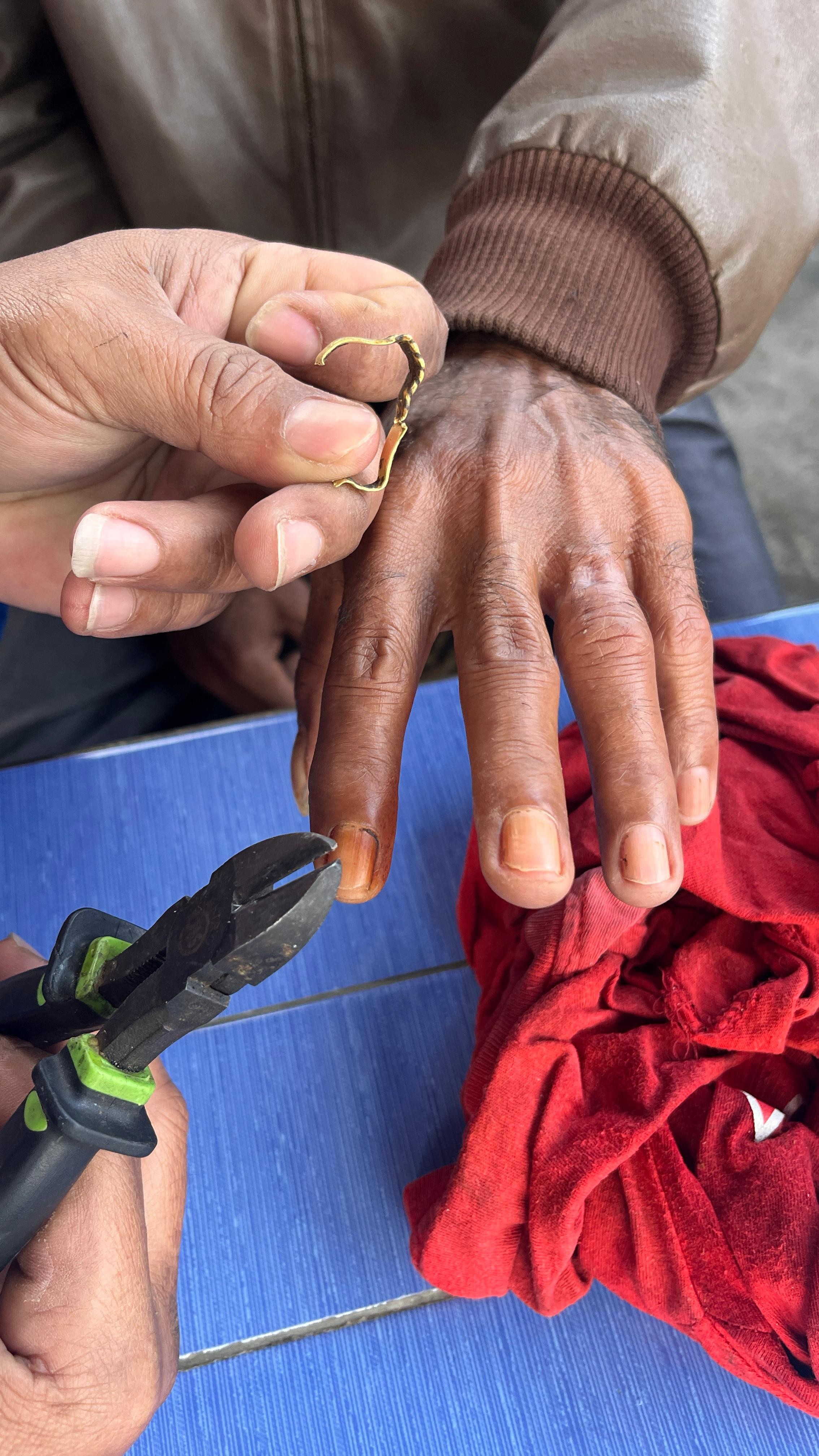 Pelepasan cincin dari Jari seorang warga 