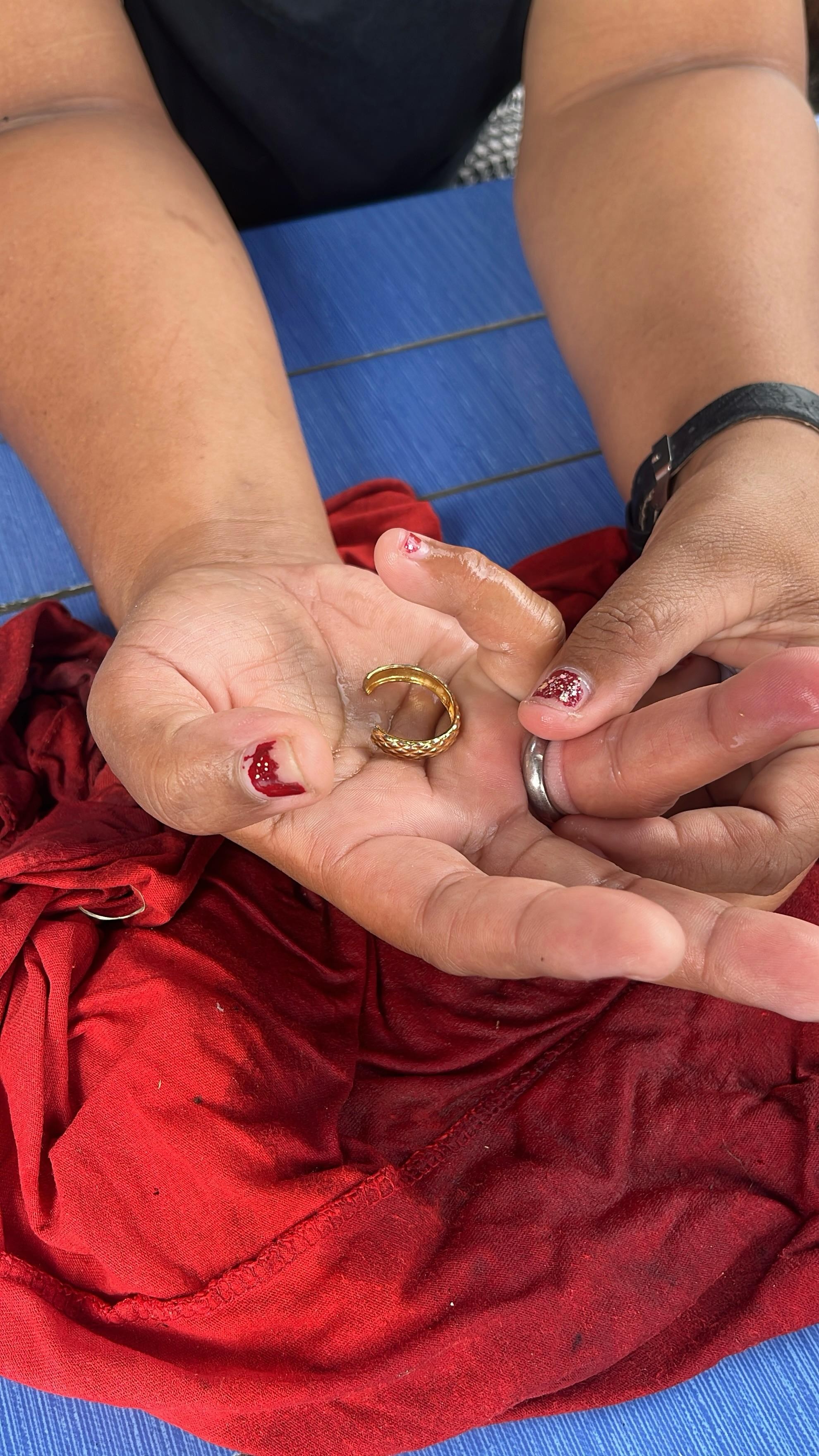 Pelepasan cincin dari Jari seorang warga yang tidak bisa dilepas yang beralamat tinggal di Jl. Par