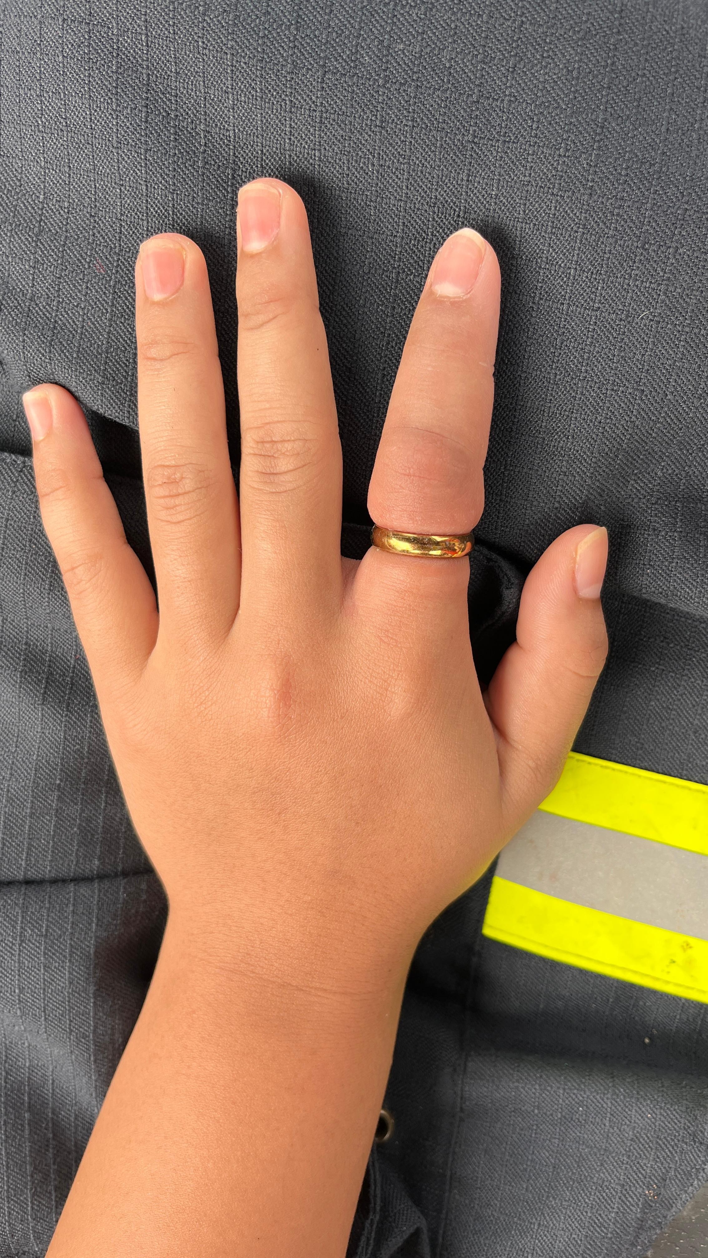 pelepasan cincin dari jari seorang warga yang beralamat tempat tinggal di Lingkungan Tapian Nauli
