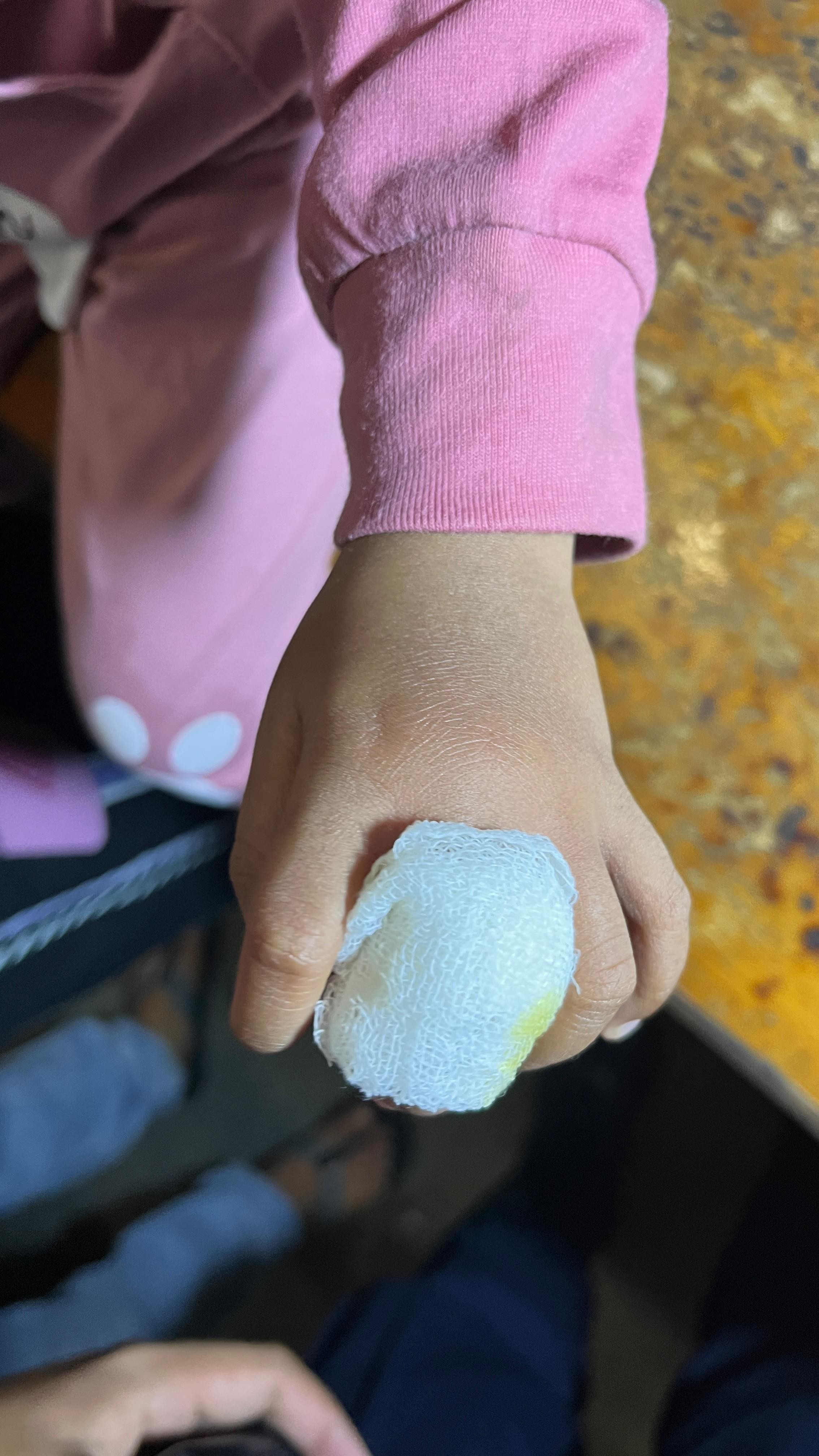 pelepasan cincin dari jari seorang anak yang beralamat tempat tinggal di Jl. Batu Permata Raya