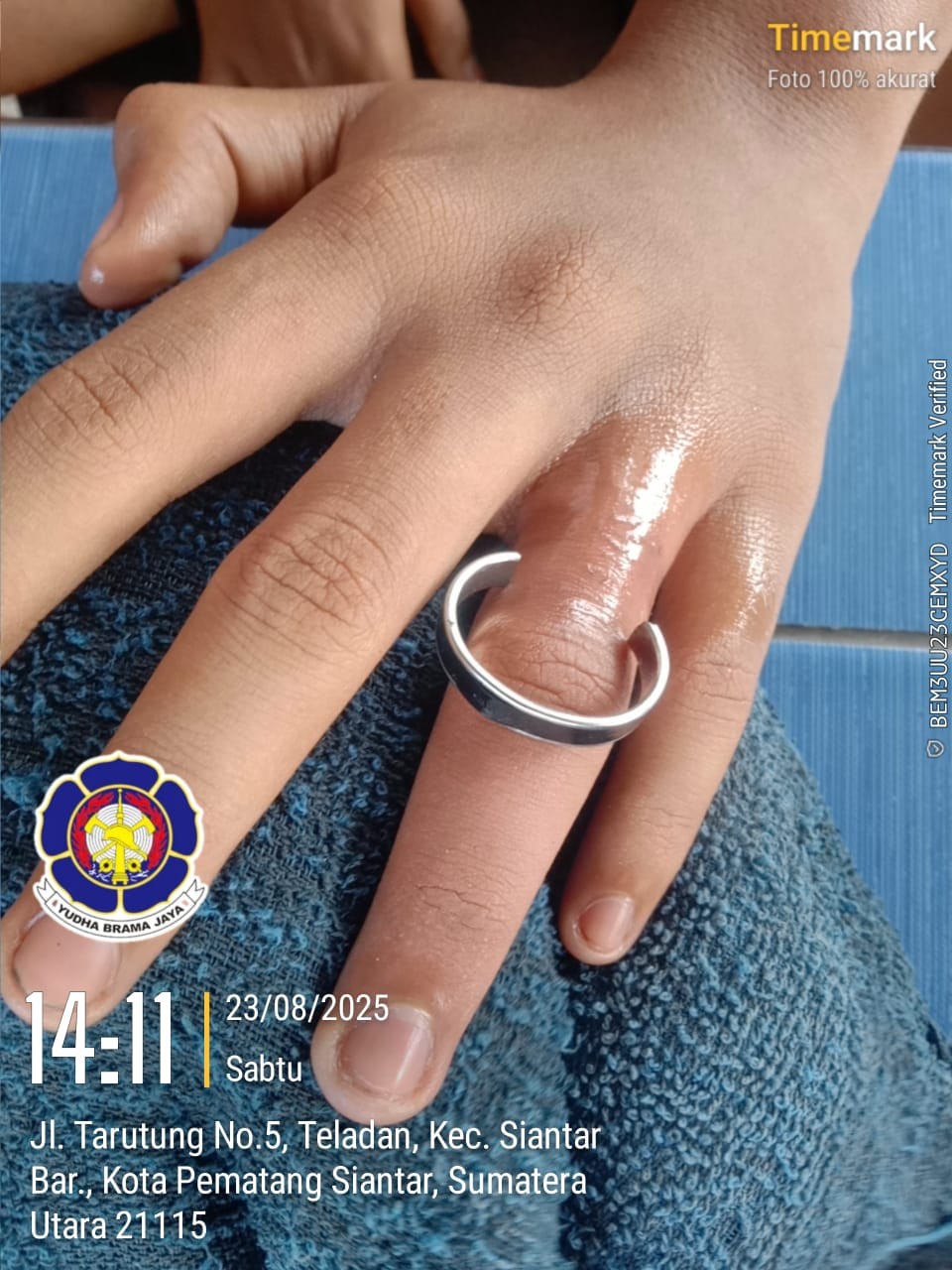 pelepasan cincin dari jari seorang warga yg tidak bisa dilepas yang beralamat di Jl. Mangga Ujung