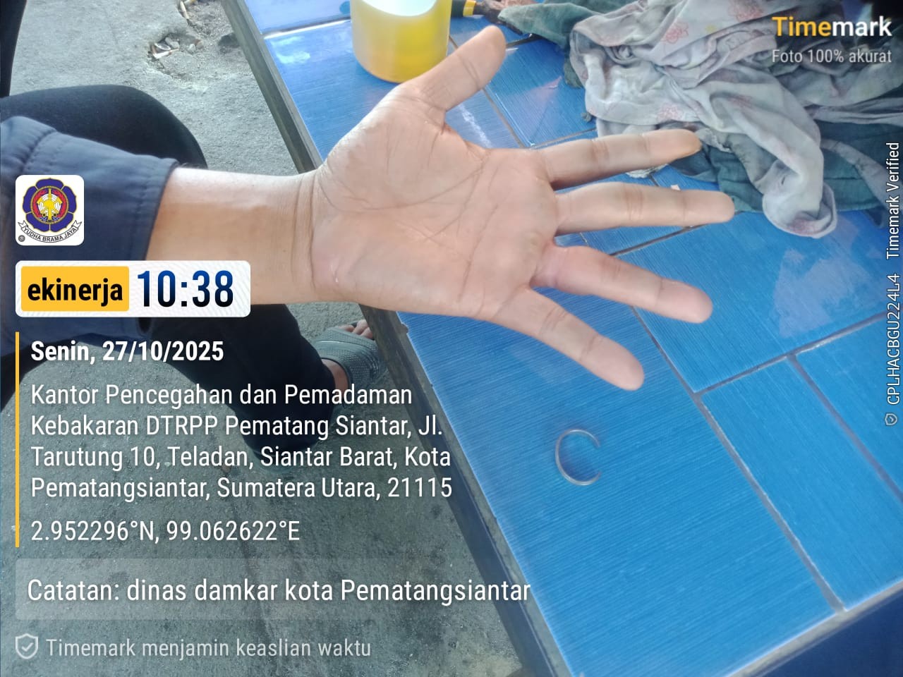 Personil Dinas Pemadam Kebakaran dan Penyelamatan berhasil melaksanakan pelepasan cincin dari jari s