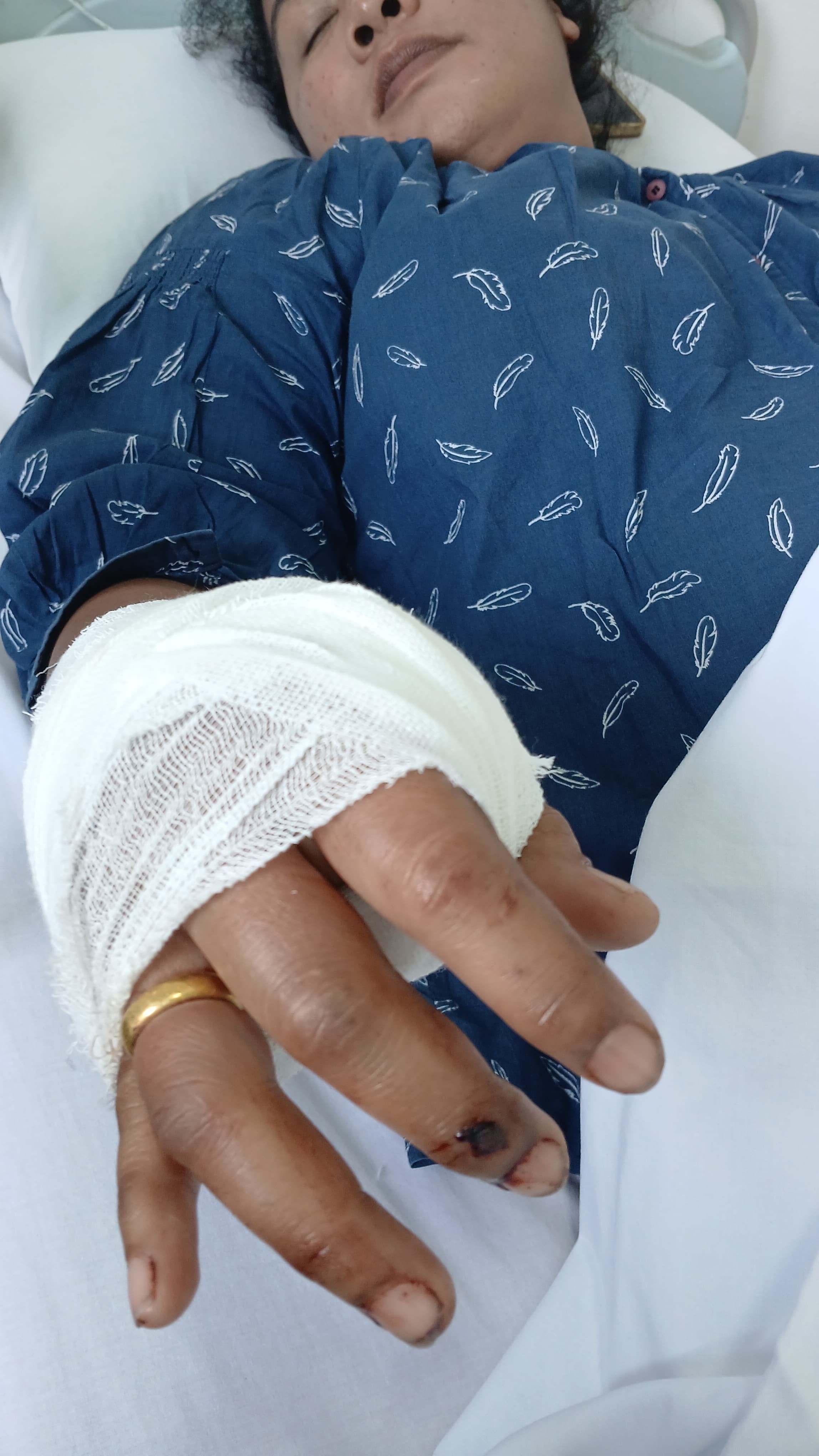 Personil Dinas Pemadam Kebakaran dan Penyelamatan berhasil melaksanakan pelepasan cincin dari jari s