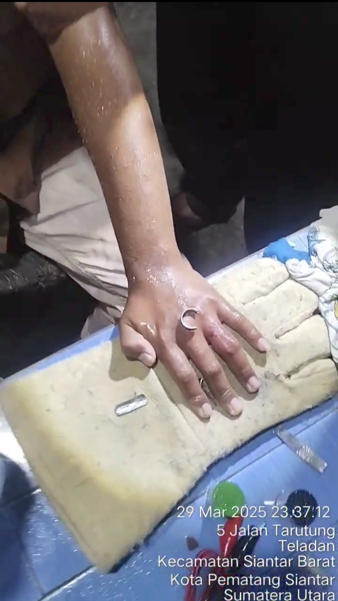 pelepasan cincin dari jari seorang warga yang beralamat tempat tinggal di